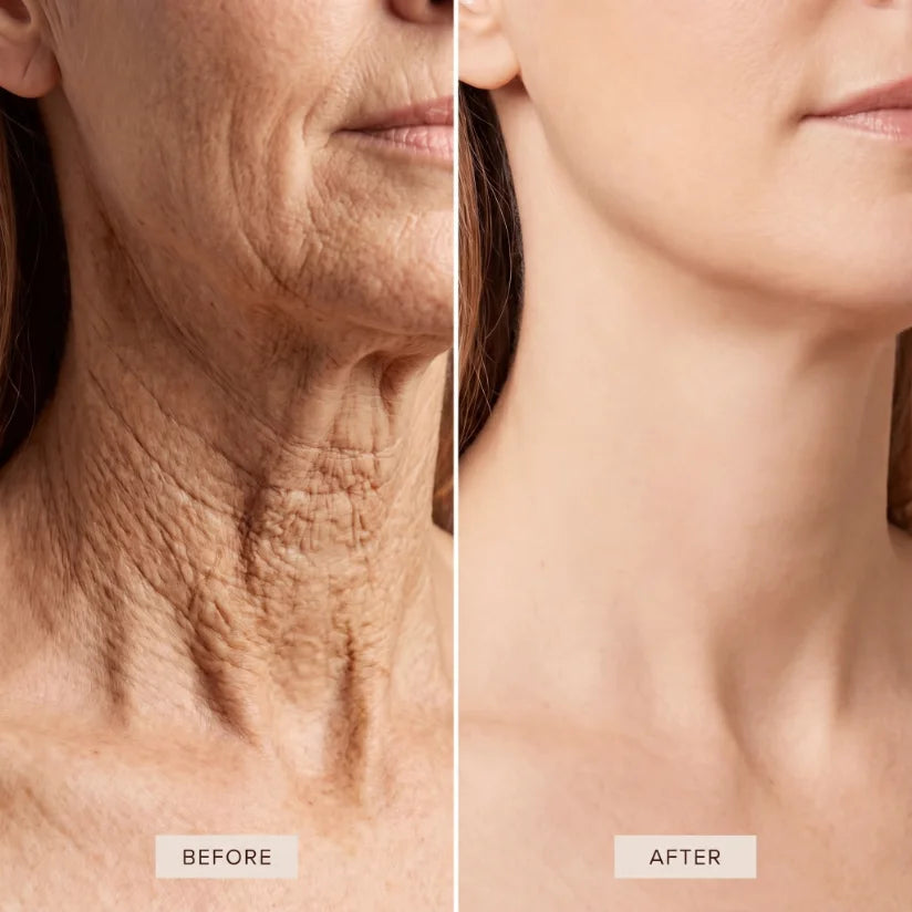 Close-up — soft-focus face, eye/cheek area